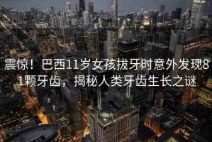 震驚！巴西11歲女孩拔牙時(shí)意外發(fā)現(xiàn)81顆牙齒，揭秘人類牙齒生長(zhǎng)之謎